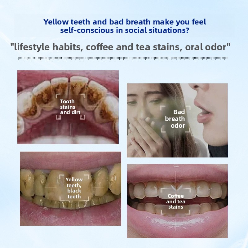 Enzyme Brightening and Whiteni - Teeth Whitening Enzymes review and price