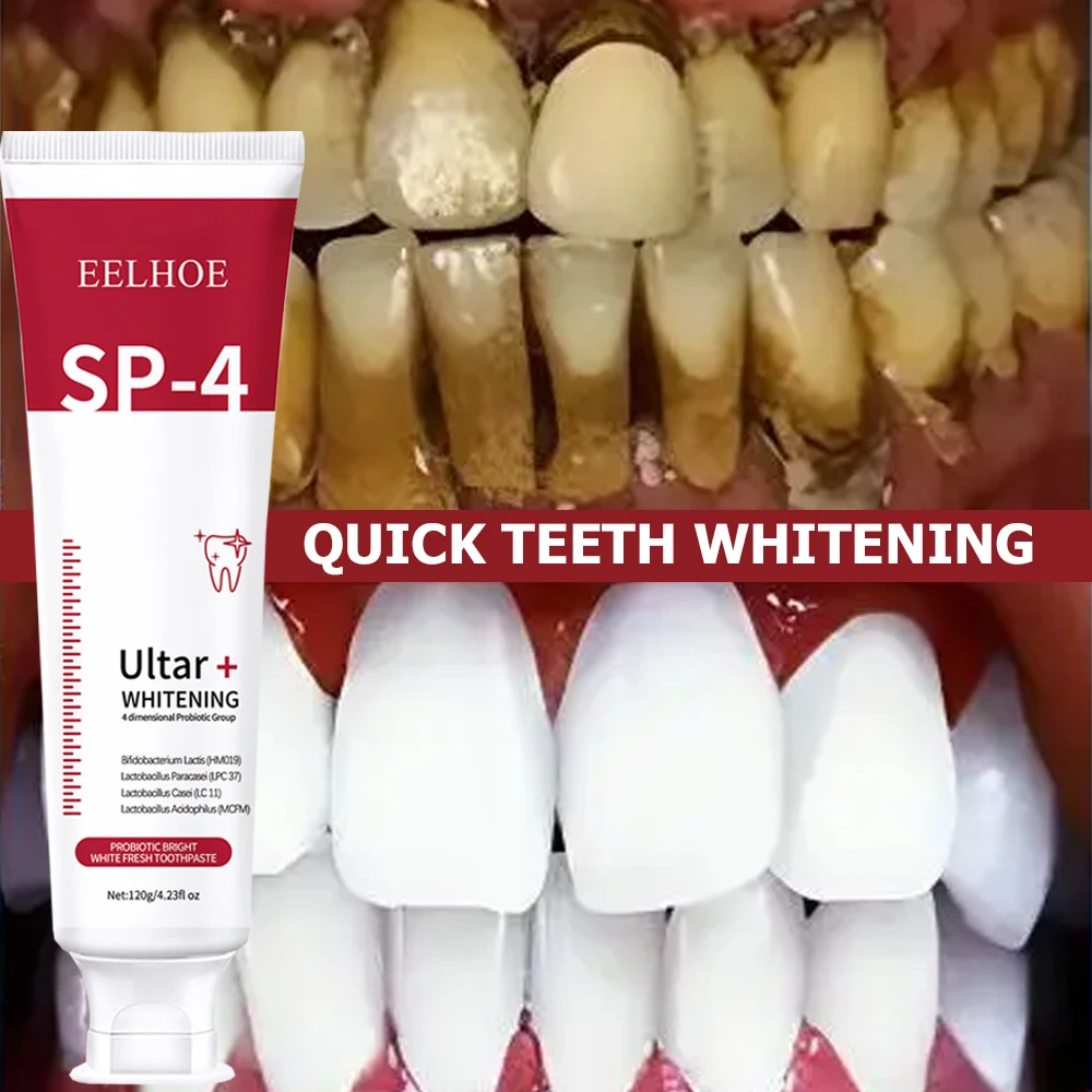 5pcs Sp-4 120g Probiotic White - Teeth Whitening Enzymes review and price