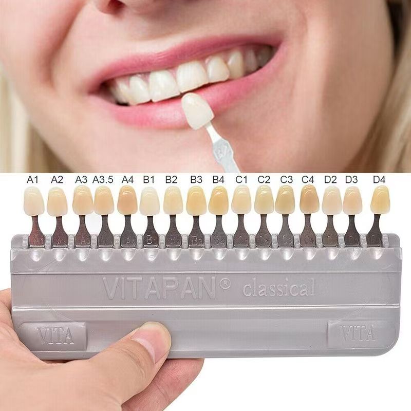 GULPOOE Dental 16 Colors Guide - Teeth Whitening Shade Guide review and price