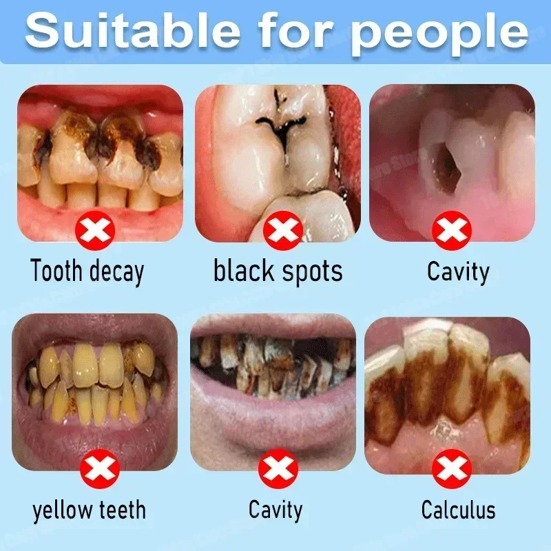 Anti Decay Toothpaste Repairs  - Teeth Whitening Toothpaste review and price