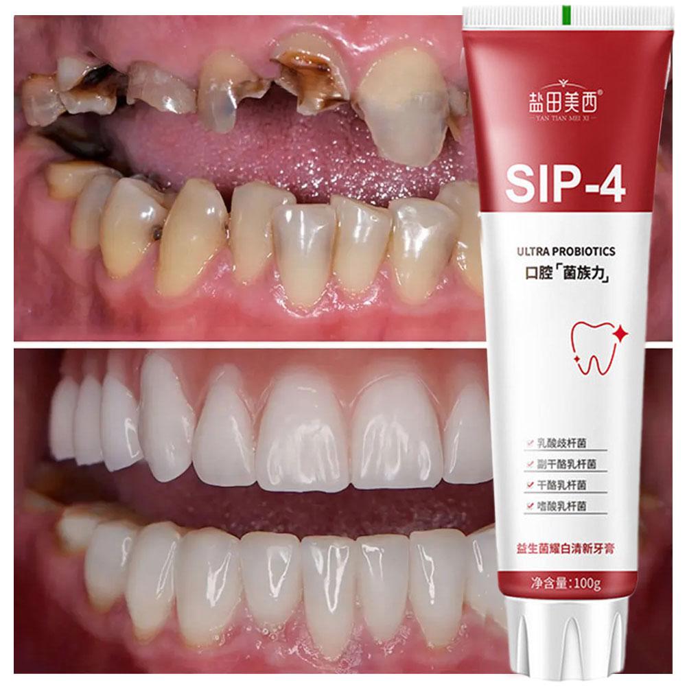 100g Sip-4 Probiotic Whitening - Teeth Whitening Toothpaste review and price