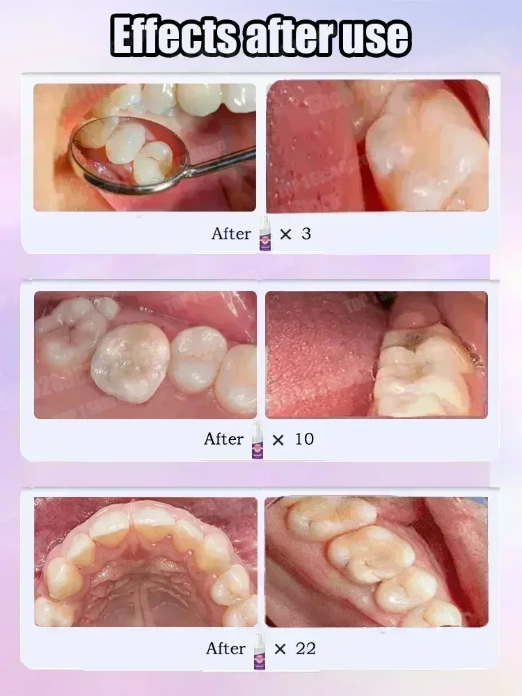 Hot sales Best-selling, Scient - Teeth Whitening Toothpaste review and price
