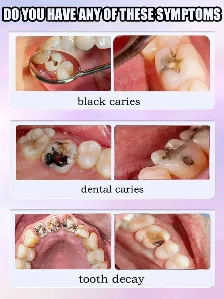 Hot sales Best-selling, Scient - Teeth Whitening Toothpaste review and price
