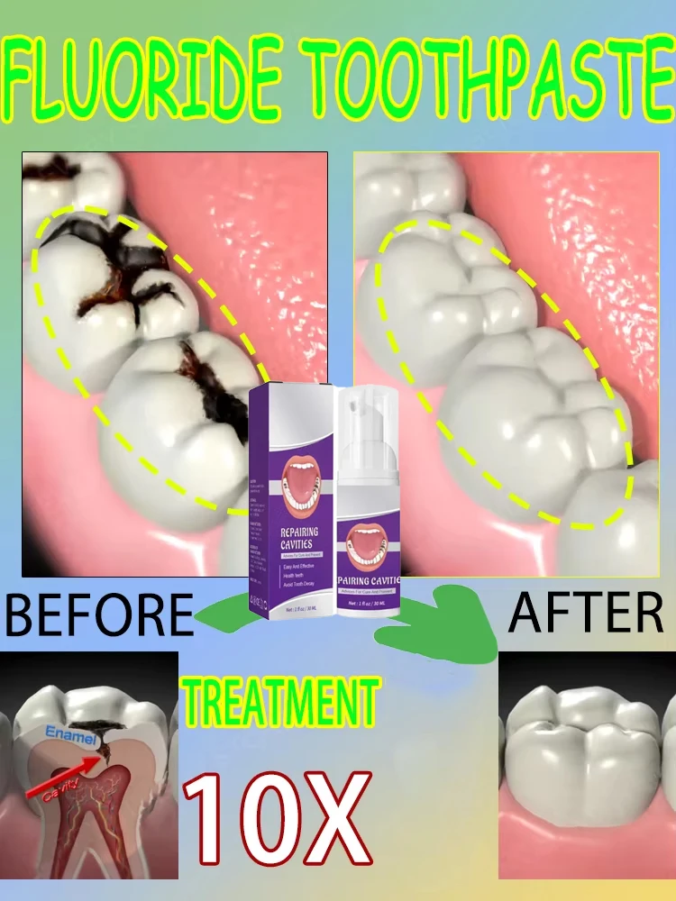Hot sales Best-selling, Scient - Teeth Whitening Toothpaste review and price