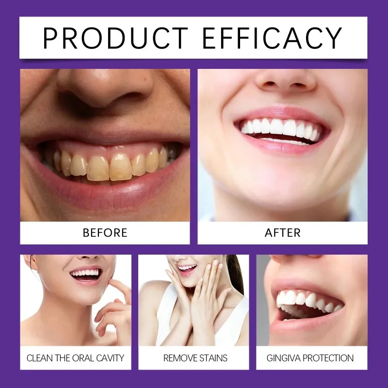 Purple Teeth Restoration Miner - Teeth Whitening Remedies review and price