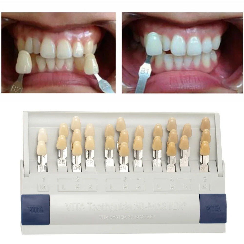 Vita 3D Master Dental Lab Blea - Teeth Whitening Shade Guide review and price